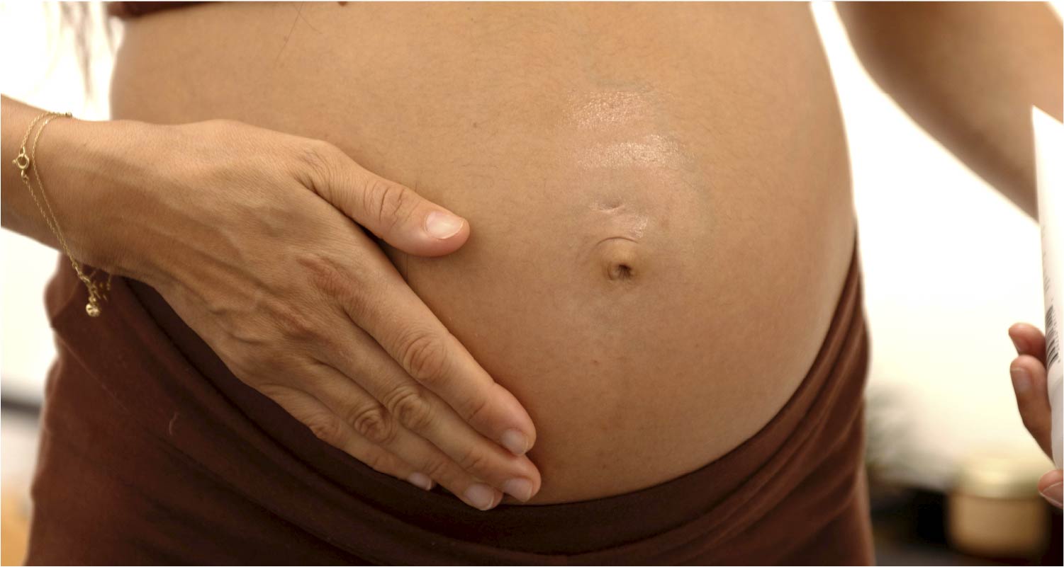 Vergetures de grossesse: 5 façons naturelles de les prévenir et de les atténuer