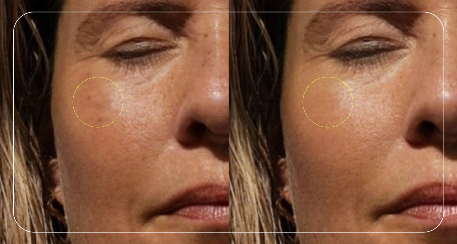 Before/after - anti-aging sunscreen-effects of too much sun exposure - ATTITUDE